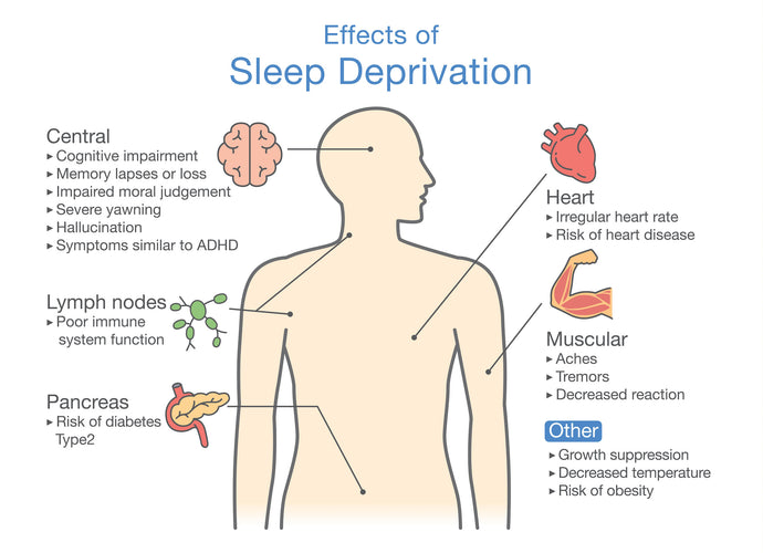 Can Sleep Deprivation Kill You? The Hidden Health Dangers